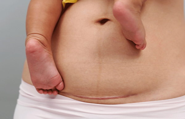 Best Pregnancy Doctor in Kolkata